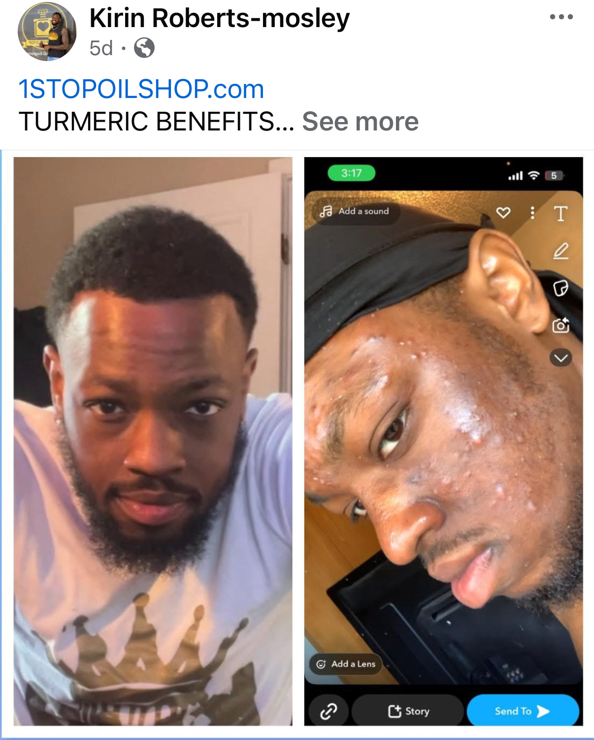 Turmeric soap and Black soap and Shea butter